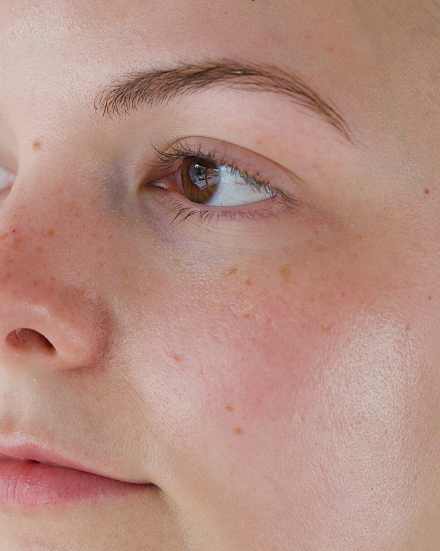 WHAT IS RETINOL AND WHY DO I NEED IT?