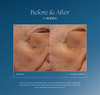 iS Clinical Daily Dynamic Hydrator