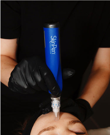 A person uses a blue SkinPen device on a forehead, wearing black gloves during a skincare treatment.