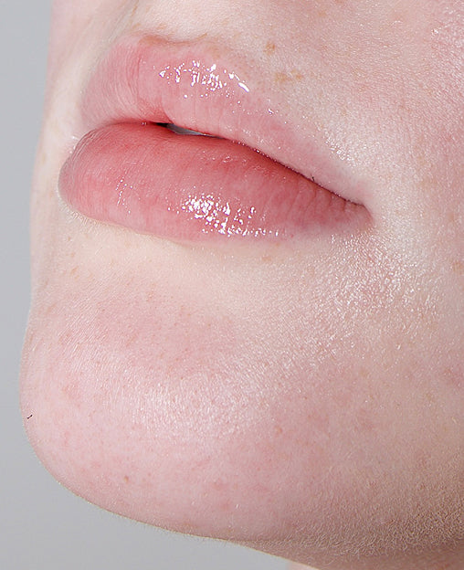 Close-up of a persons lips and chin with glossy pink lip balm and smooth, fair skin.